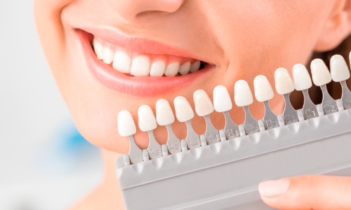 Estética Dental Estética Dental