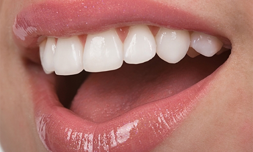 Estética Dental Estética Dental