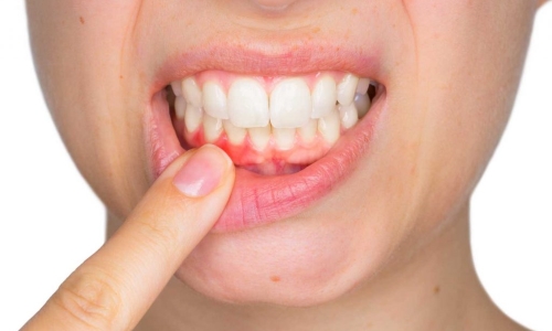 Periodoncia Periodoncia