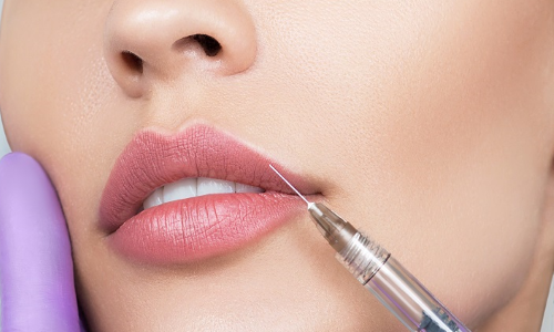 Relleno Labios Relleno Labios